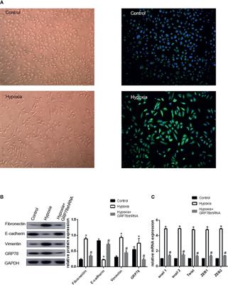 Corrigendum: Glucose-Regulated Protein 78 Signaling Regulates Hypoxia-Induced Epithelial–Mesenchymal Transition in A549 Cells